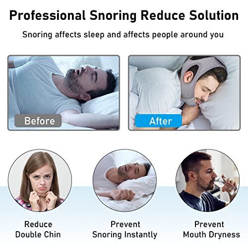 Best image of anti-snore chin straps