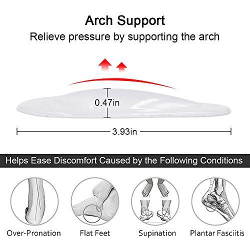 Best image of arch supports