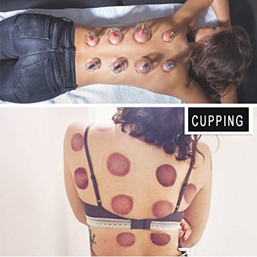 29+ Suction massage cups reviews ideas