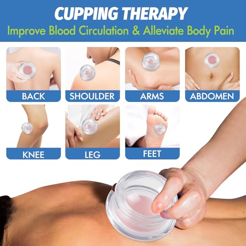 Best image of cupping sets