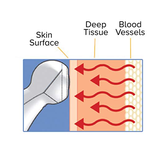 Best image of forehead thermometers